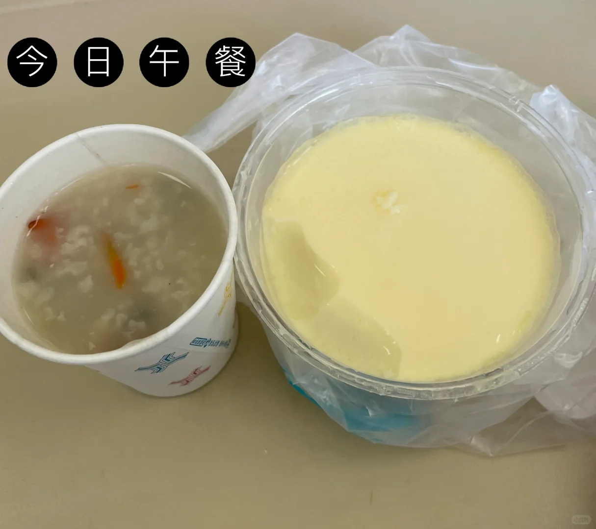 肝移植成功移植的第五天