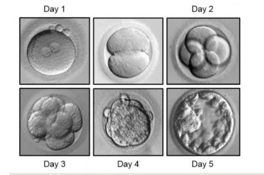 鲜胚，冻胚，囊胚区别,代孕方案套餐