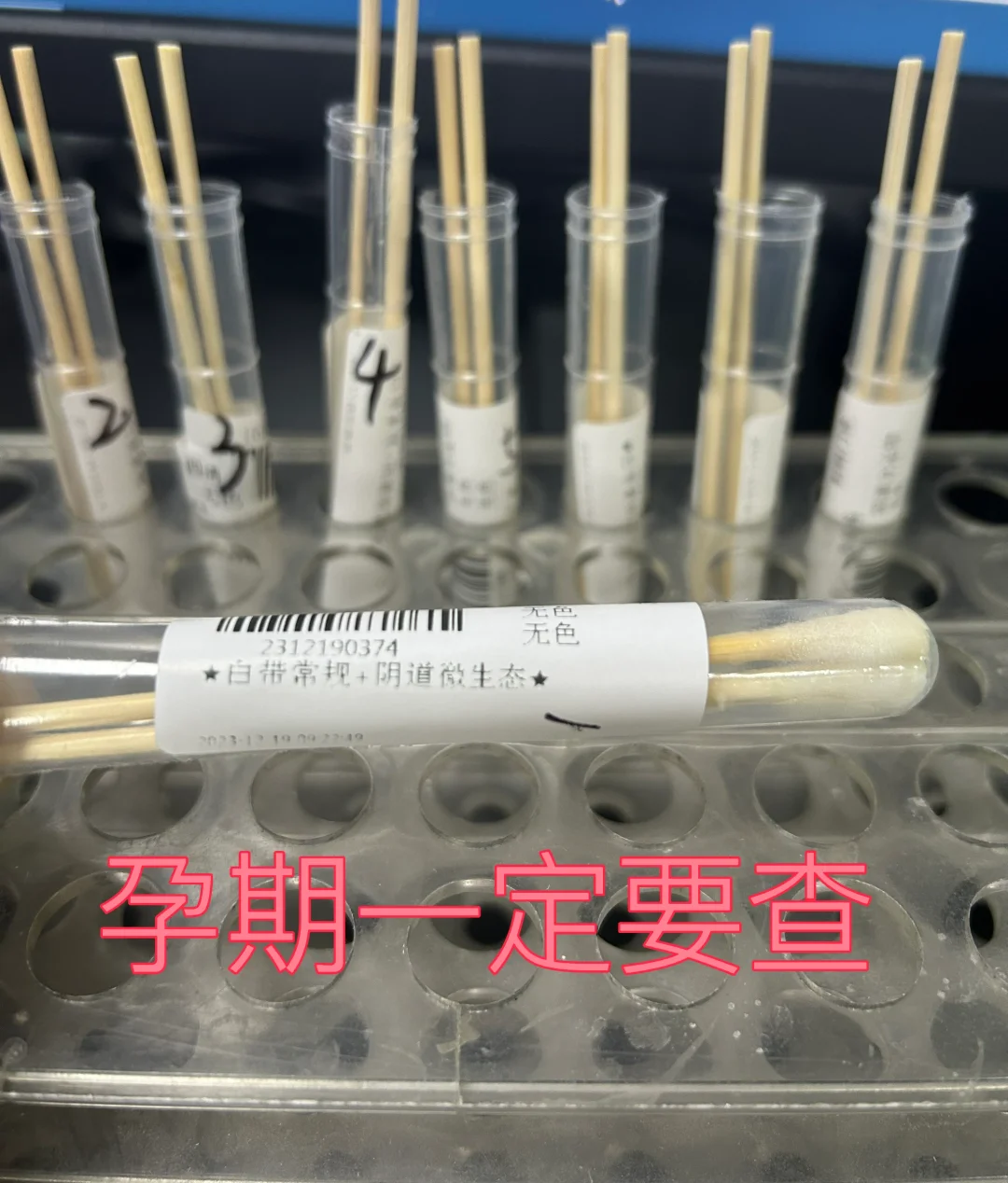 孕期为什么要查白带