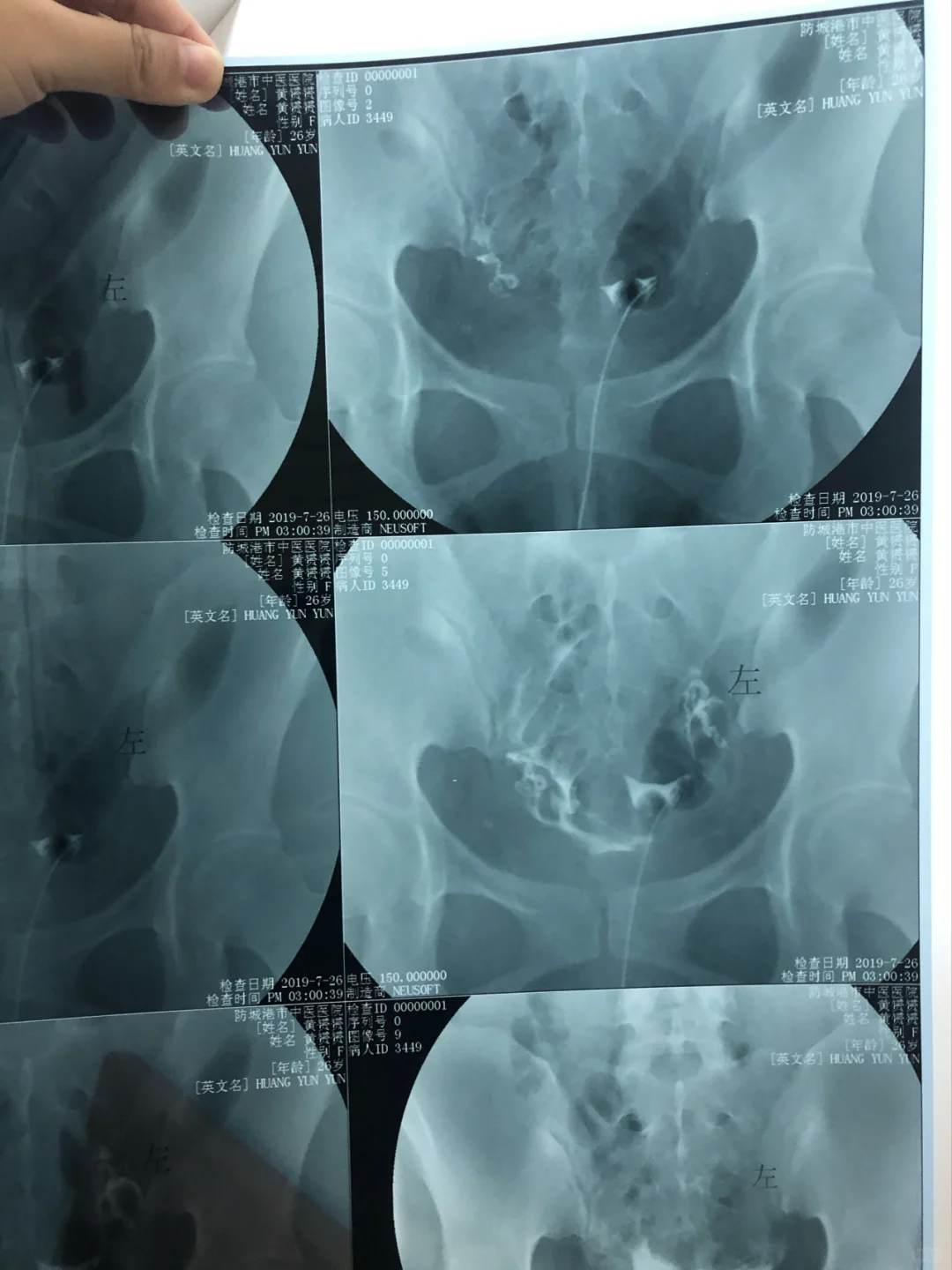 不要相信抖音医生！简直大坑！害人！